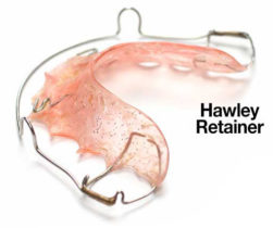 hawley-retainer-2